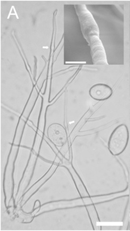 Phytophthora infestans